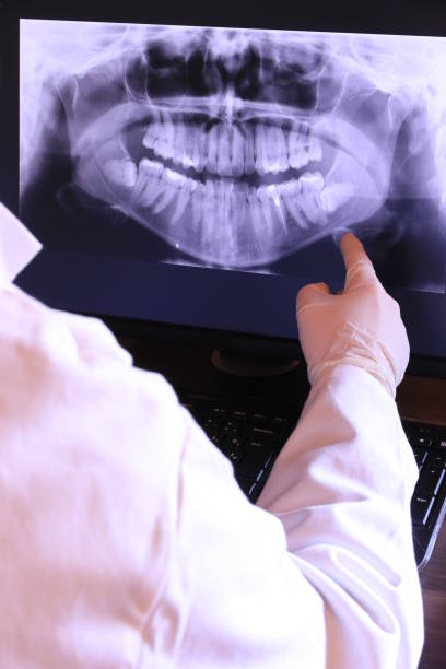 Best Emergency Gum Treatment in Milford, PA